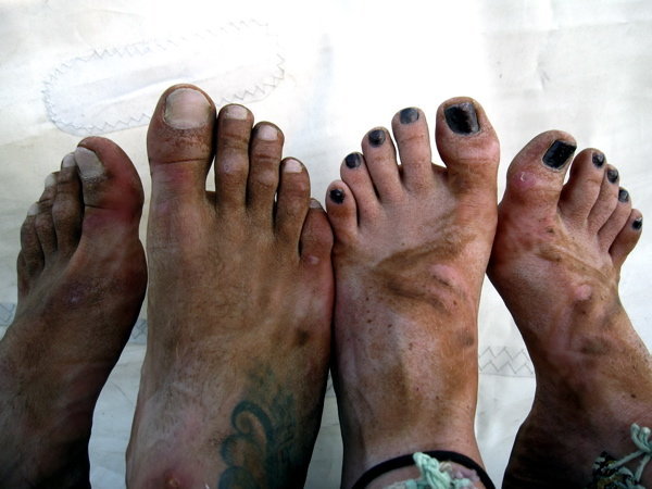 Dirty Hippi feet