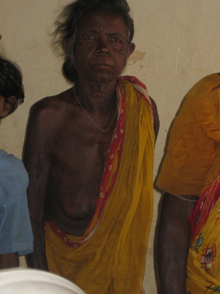 Old Village Woman waiting to see doctor