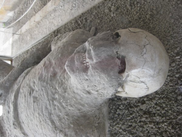 The remains of this person are seen underneath the cast