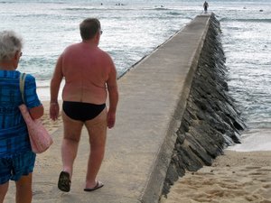 this is why you dont wear speedos!!!!