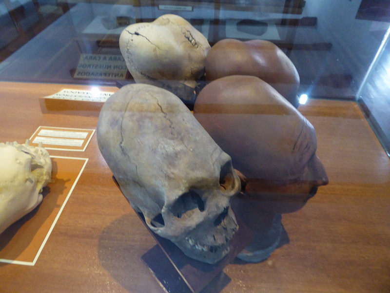 Elongated skull of an influential person