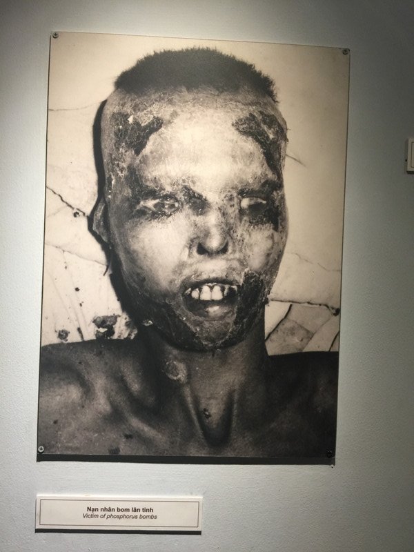 Agent Orange Victim.Source:Vietnam War Remnant Museum in Ho Chi Minh City.