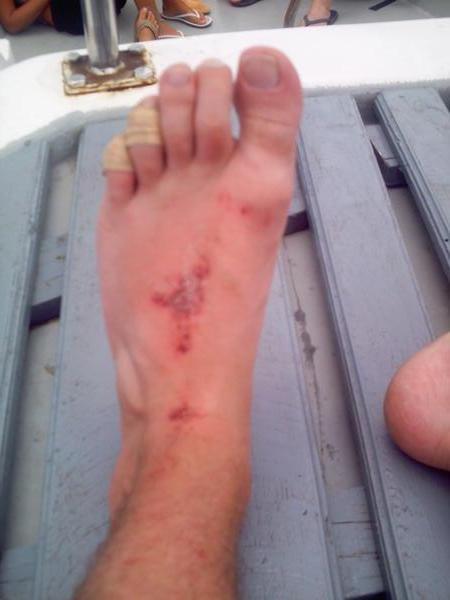Lesson Learned: don't pick a fight with a thai punchbag without shoes on