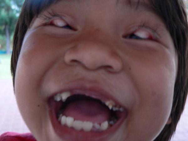 Aren't Kids Cute?, Mercy Home, Khon Kaen
