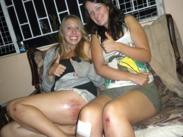 Brittney and me with our injuries