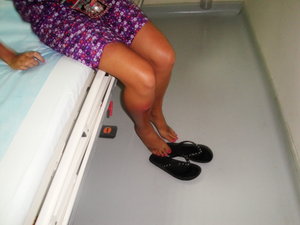Fay's leg before it got worse!!