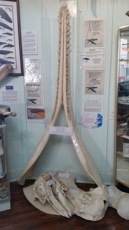 Only the Lower Jaw of the Sperm Whale Has Teeth Used to Grasp Prey that Is Then Swallowed Whole