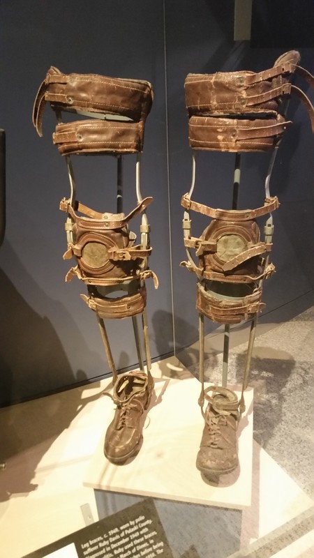 Polio Victim Ruby Davis Of Pulaski County IN Wore These Leg Braces Until She Was Confined To A Wheelchair In 1959 - She Died In 2007 At The Age Of 87