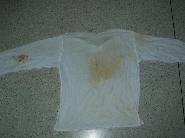 The bloodied shirt