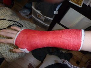 another cast
