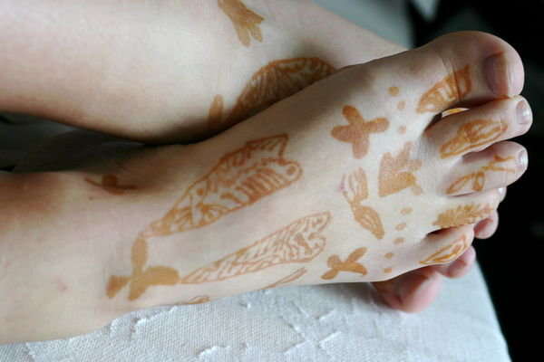 Another victim of 'backyard henna art'