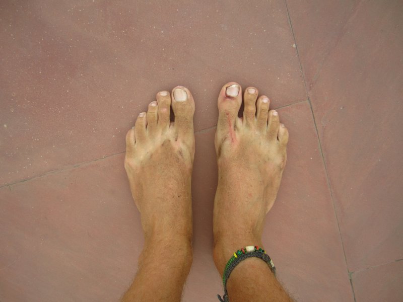 My feet after walking through Delhi.