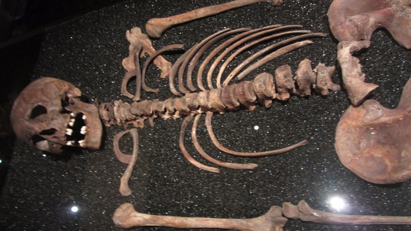 One of the skeletons