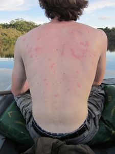 My Back After Falling In the Creek