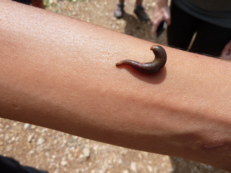 The leech on Yoga's arm after he had pulled it from his ankle