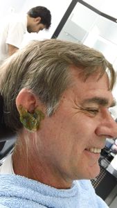 Dad has ear wax problem