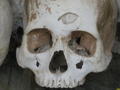 A SKULL AT THE KILLING FIELDS