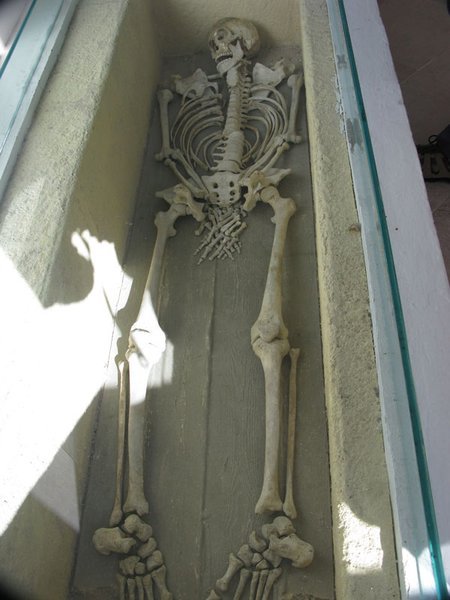 Skeletal remains