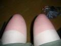 Sunburnt legs