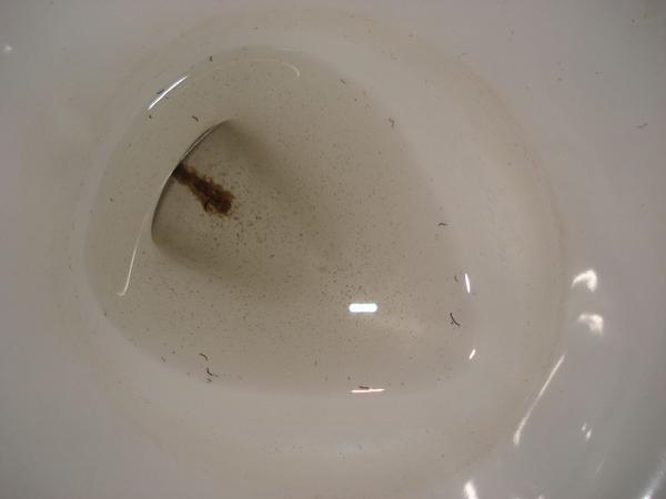Worms in the toilet