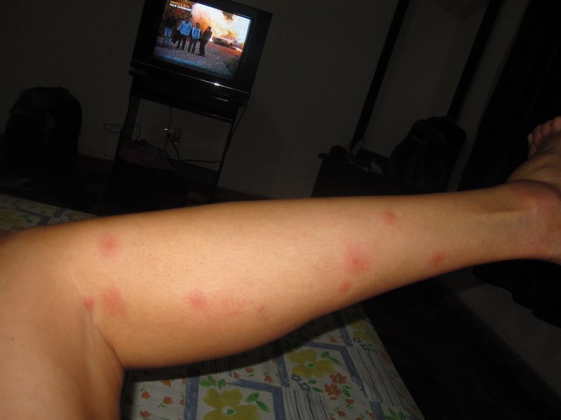 Salsa dancing attracts mosquitoes.