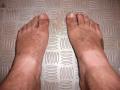 My minging feet after a few days in the bush