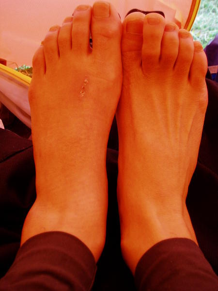 look my left ankle