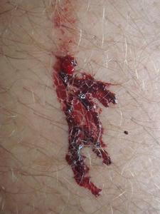 Bloody leg after a leech bite - poor Chris :-)