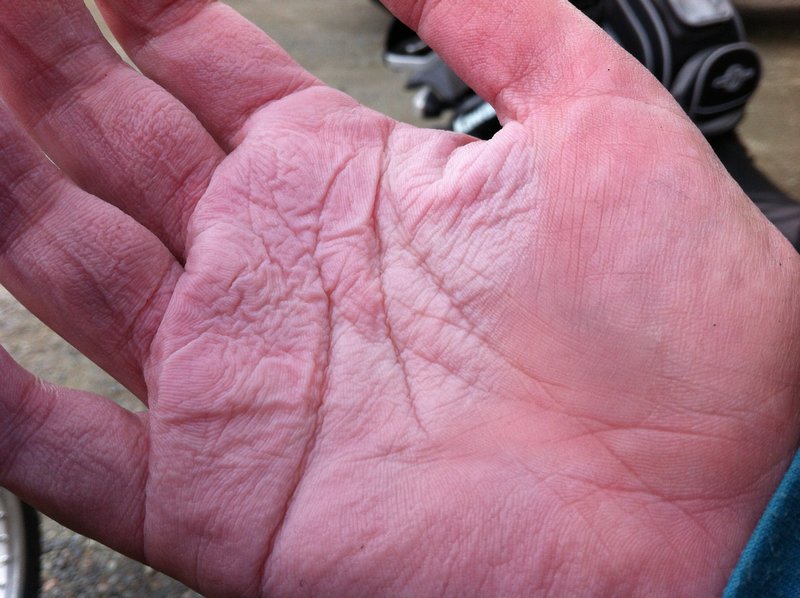 Waterlogged hand part I