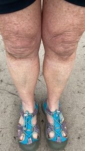 Dirty Legs