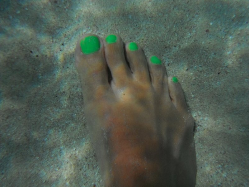 Green toenails
