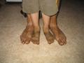 Bushwalking feet