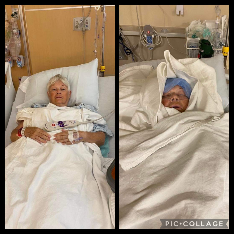 Before and after anesthesia….me