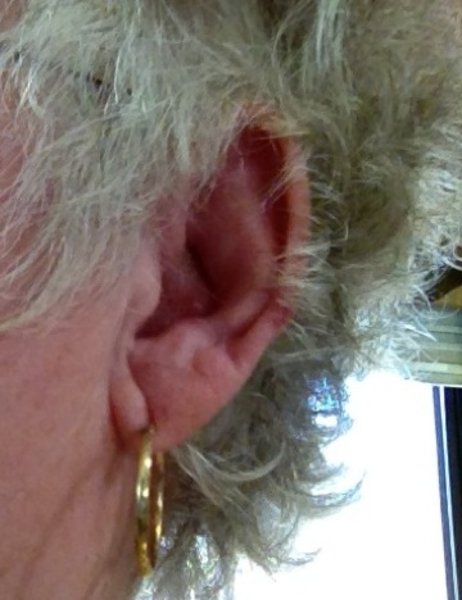 My Ear