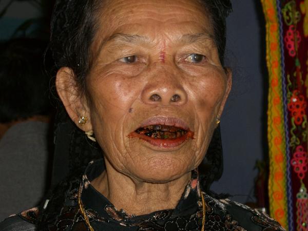 Chewing Beetle nut (opium paste wrapped in leaves) will do this to your ...