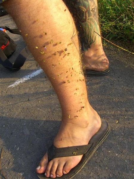 Jeff's leg covered in sticky flower things