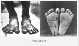 what feet should look like