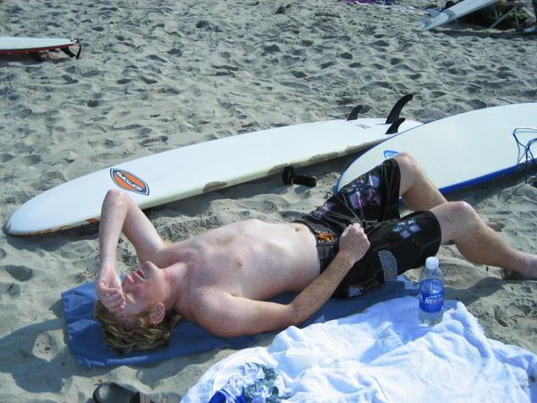 Joe wrecked from surfing
