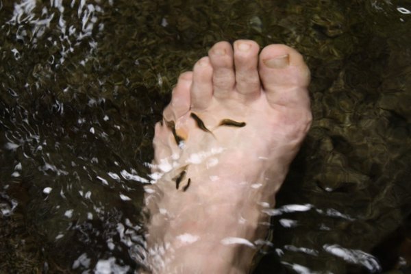 small fish nibbling away at dead skin on Colins feet