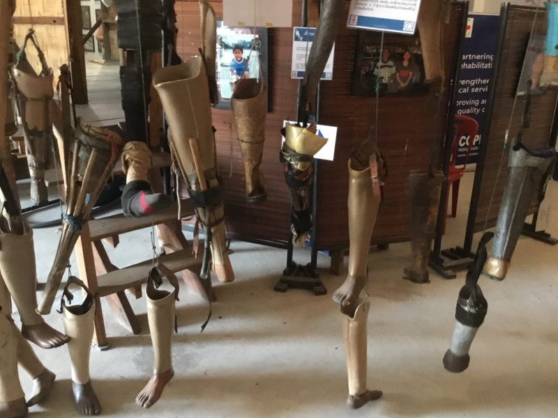 COPE Museum, prosthetics
