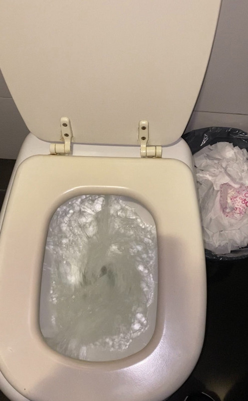 Toilet flushes backwards