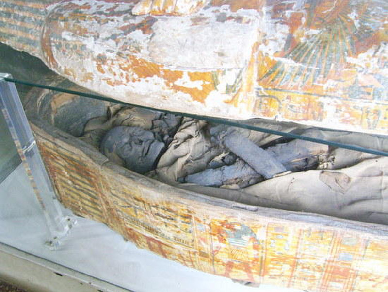 20 A mummy