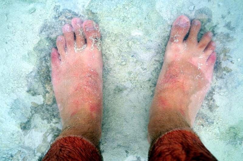 Imagine some put this on their face...with all those feet in the water!