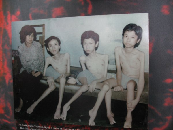 War Remnants Museum photo: A mom with her three sons; effects of the toxic chemicals dumped by the USA