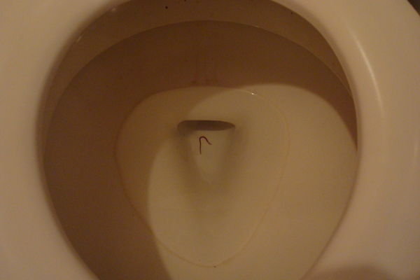 The Ecuadorian Toilet Worm