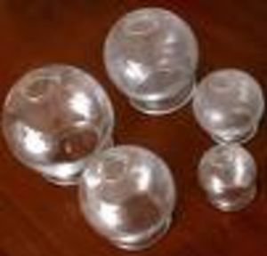 here's a pic of the glass cups from google