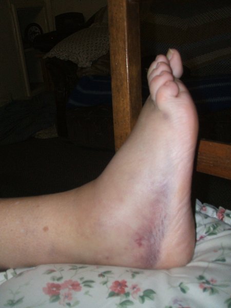 purple foot