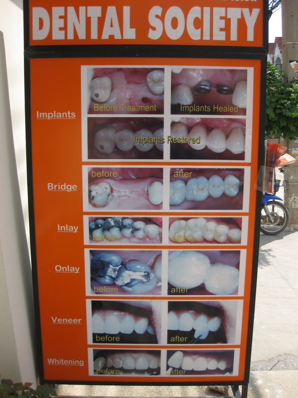 Dentist Pattaya