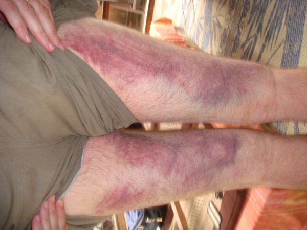 Daves legs after his impressive dive