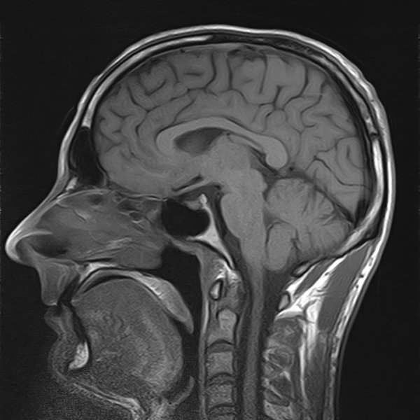 MRI scan of my brain - looks pretty big, um?